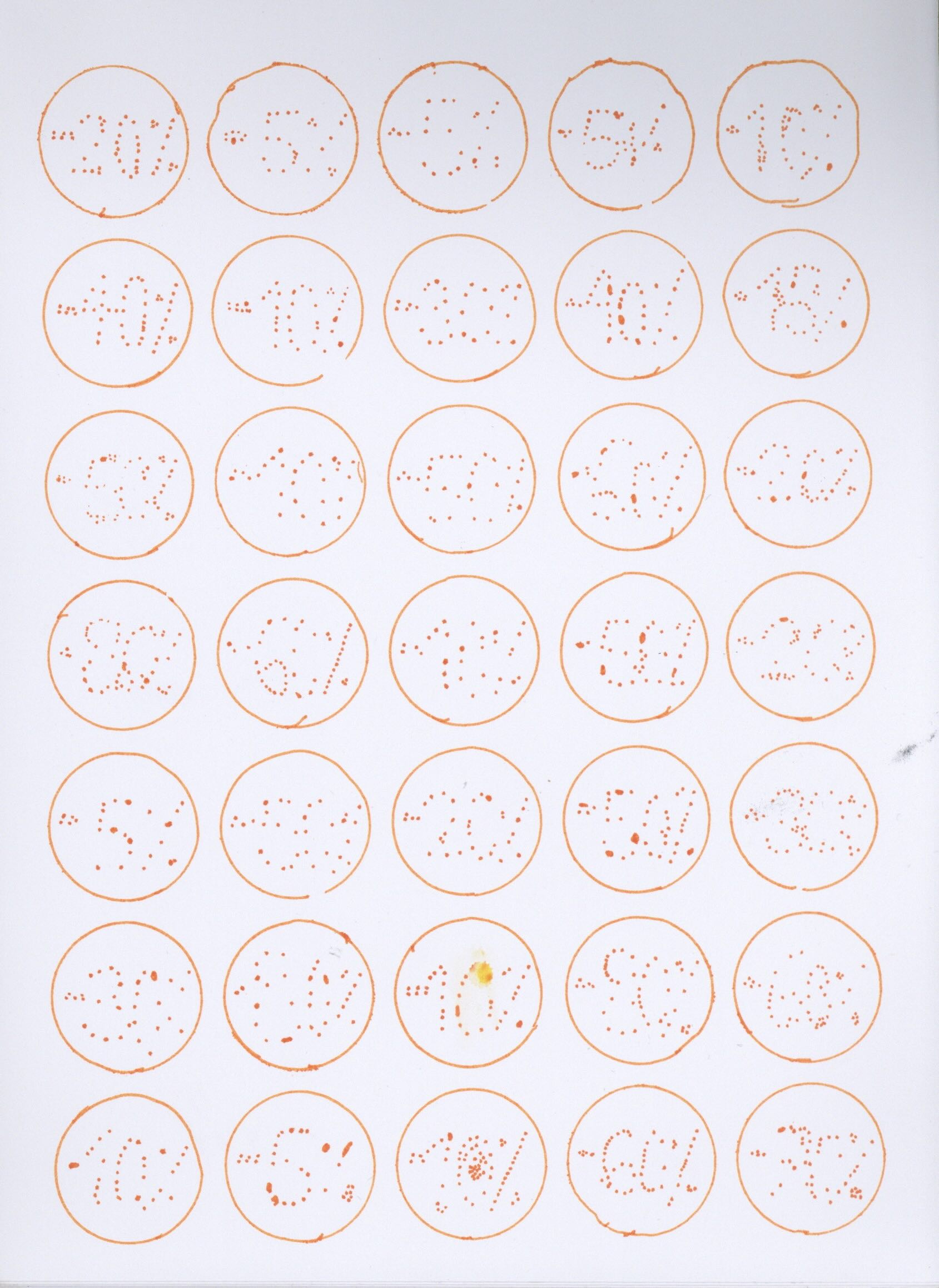 Summer is over, freckles for sale